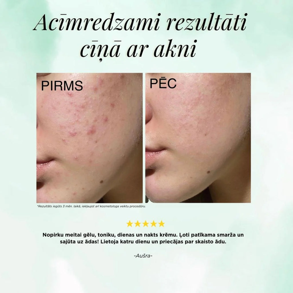 ANTI-ACNE ATTĪROŠS GELS, 200ml
