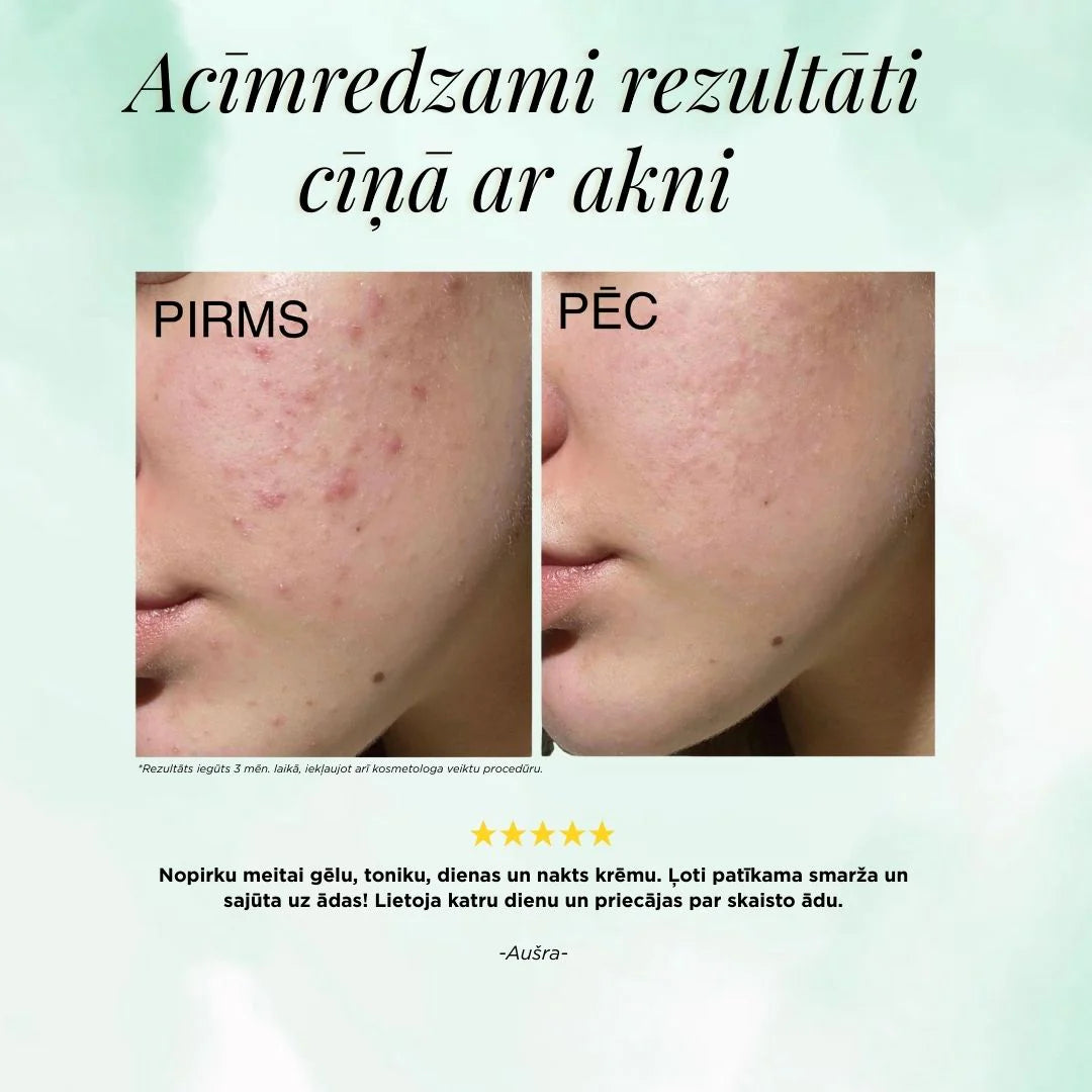 ANTI-ACNE ATTĪROŠS GELS, 200ml